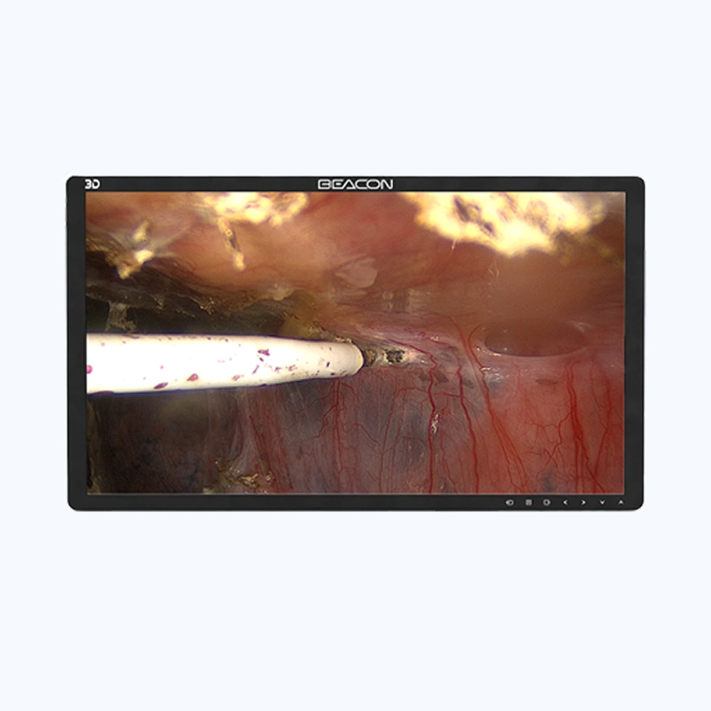 Монитор хирургический S3221P-3D